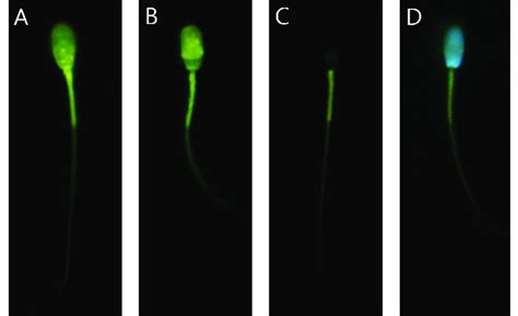 Different Patterns Of Spermatozoa In Combined H33258ctc Staining A Download Scientific