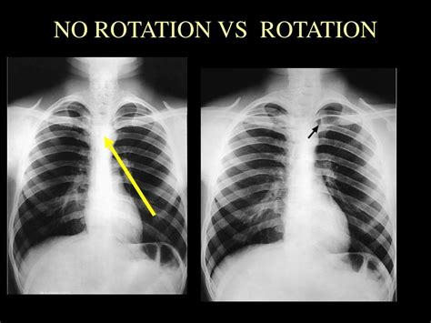 PPT Basic Radiographic Procedures CHEST LAB PowerPoint Presentation