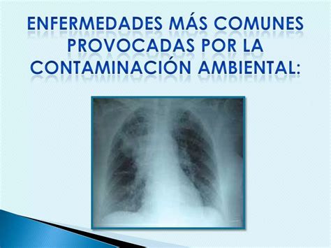 Enfermedades Causadas Por Gases Ambientales Ppt