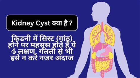 Kidney Cyst Symptoms in Hindi: किडनी में सिस्ट (गांठ) होने पर महसूस ...