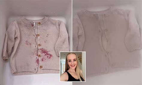 Influencer Reveals Amazing Second Hack That Instantly Removes Stains With Just Hot Water