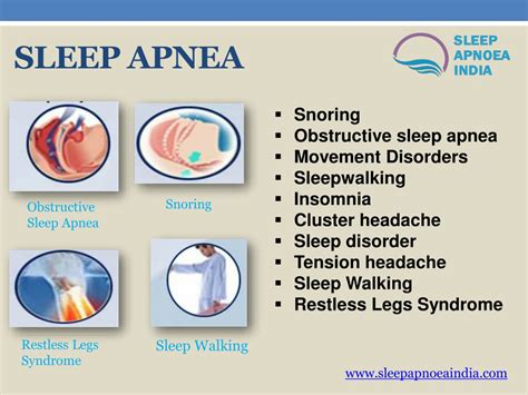 Ppt Sleep Apnea Test Powerpoint Presentation Free Download Id 11736317