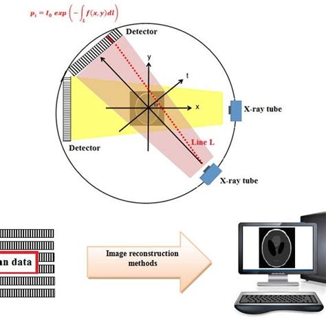 Reconstruction of computed tomography | Download Scientific Diagram