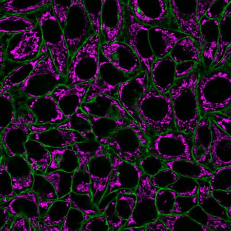 Cellbrite® Steady Membrane Staining Kits Biotium