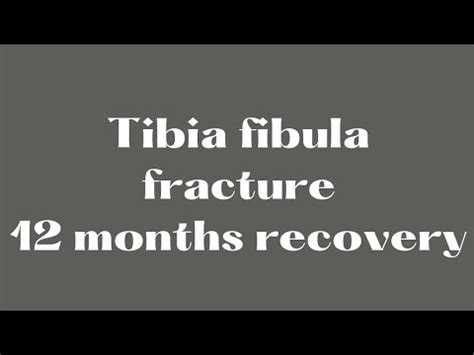 Tibia Fibula Fracture Recovery Walking Video Climbing Stairs