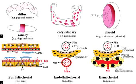 Discoid Placenta