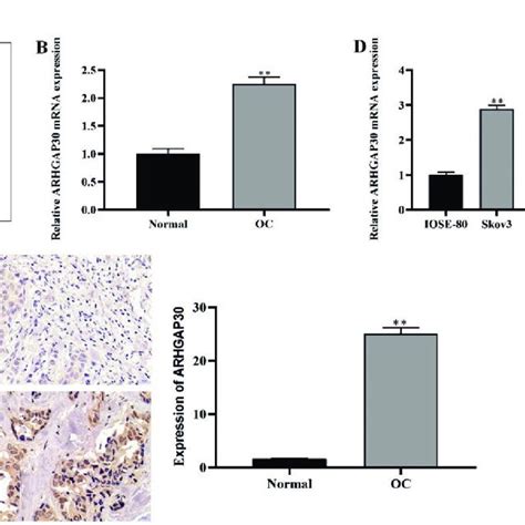 ARHGAP30 Downregulation Inhibited OC Cell Growth And Spread And