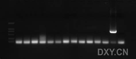 Pcr扩增带异常的原因及分析生物器材网