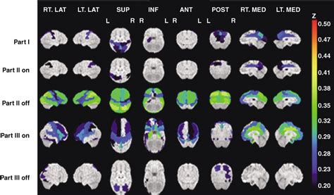 Scheme Showing The Correlation Of Regional Cerebral Blood Flow With