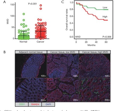 Figure From Multiplex Fluorescent Immunohistochemistry Quantitatively