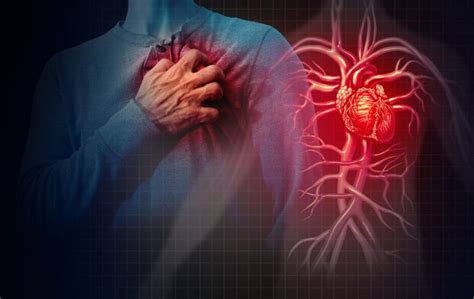 Angina Types Of Angina Symptoms And Treatment Choices