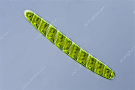 Spirotaenia Sp Green Alga Lm Stock Image C0216977 Science