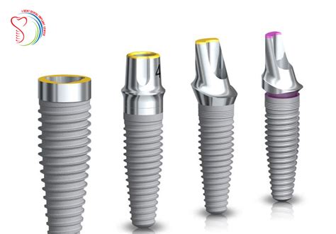 High Implant System Nobel Biocare And Straumann