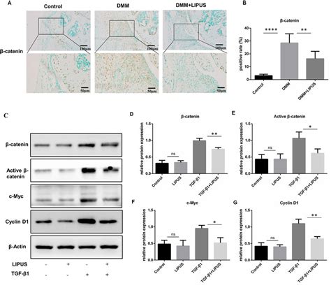 LIPUS suppresses Wnt β catenin signaling in vivo and in vitro A and B