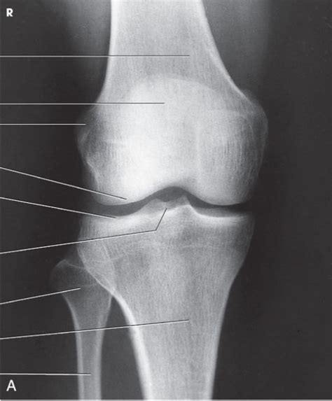 Knee Patella Labeled Anatomy Diagram Quizlet Sexiz Pix