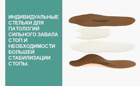 Изготовление индивидуальных ортопедических стелек на заказ в Москве по ...