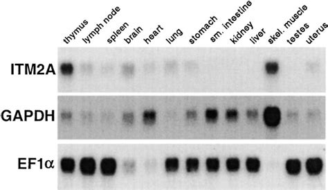 Analysis of ITM2A expression in several tissues 2 μg of mRNA was