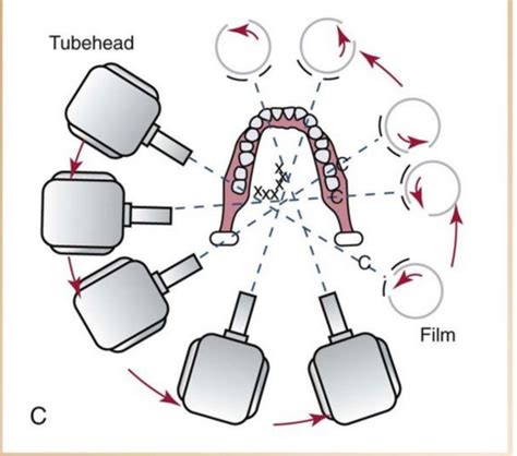 Panoramic Radiographs Chapter 23 Flashcards Quizlet