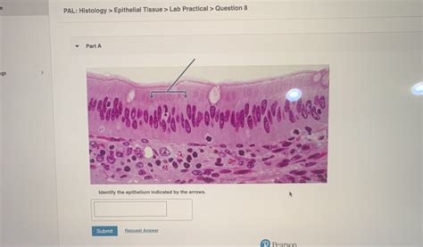 Solved PAL Histology Epithelial Tissue Lab Practical Chegg