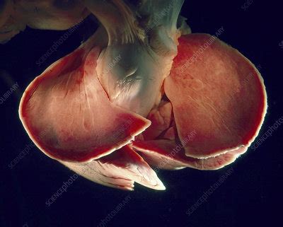 Lungs Of A Newborn Stock Image C048 8677 Science Photo Library