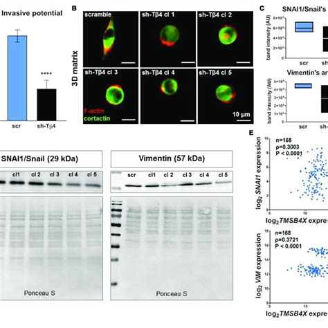 Focal Adhesion Formation In WM1341D And A375 Cells And Effect Of