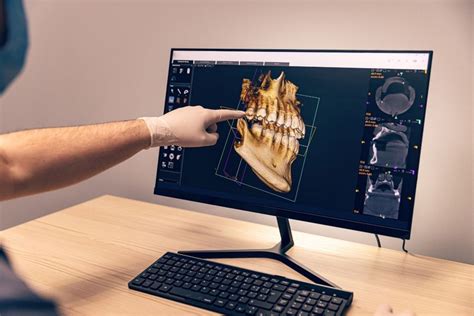 Cos è l implantologia computer guidata e i vantaggi per il paziente