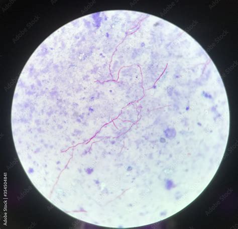 Red Branching Mycobacterium Tuberculosis On Blue Background In Modified Acid Fast Bacilli Stain