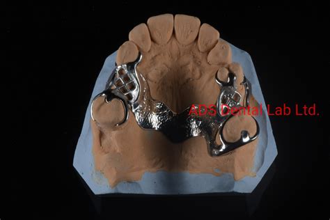 Full Service Cast Partial Denture Co Cr Cast Metal Framework Ads Dental