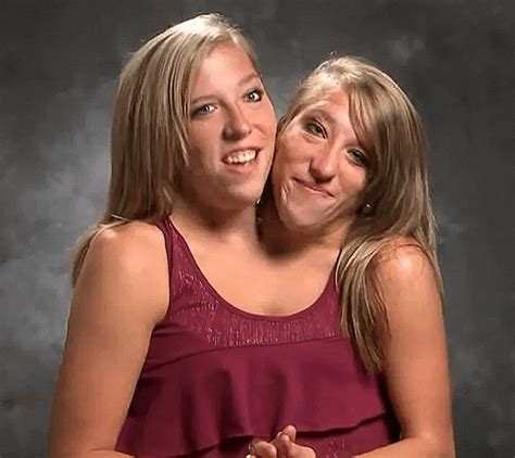 Conjoined Twins Abby And Brittany Hensel See Comments For More Info U Truth Warrior 30