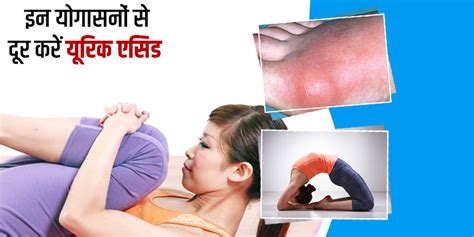 Yoga Asanas To Control Uric Acid In Hindi यूरिक एसिड को कंट्रोल करने