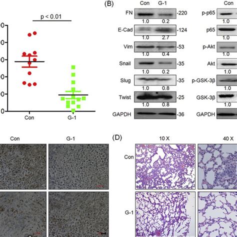 E Activation Of Gper Inhibits The Growth And Metastasis Of Tnbc In