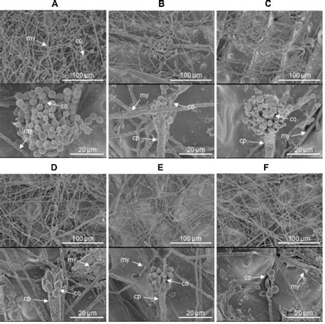 Scanning Electron Micrographs Of Fungal Structure On Rice Surfaces