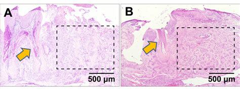 The Establishment Of A Murine Mandibular Molar Extraction Socket