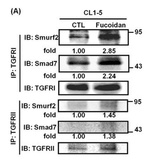 The Novel Mechanism Of Fucoidans Anti Tumor Activity Cancer And Fucoidan