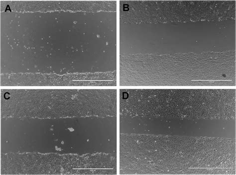 Phase Contrast Images Of Representative Gaps Created In Confluent