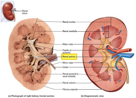 Renal Pelvis Anatomy Function Blockage Cancer And Stone