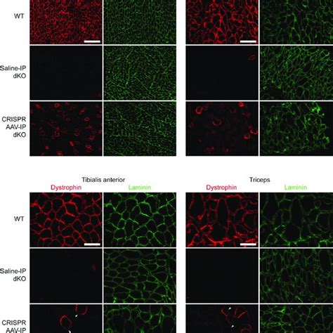 Dystrophin Restoration In Tissue Sections From IP CRISPR AAV Treated