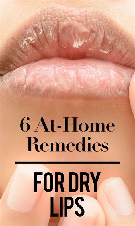 At Home Remedies For Dry Lips Artofit