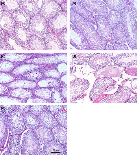 Normal Testis Histology