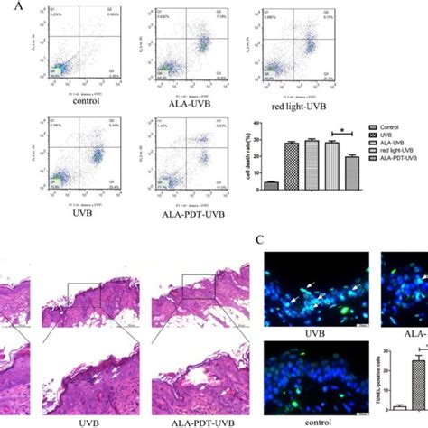 Ala Pdt Suppressed Uvb Induced Apoptosis A Evaluation Of Apoptosis