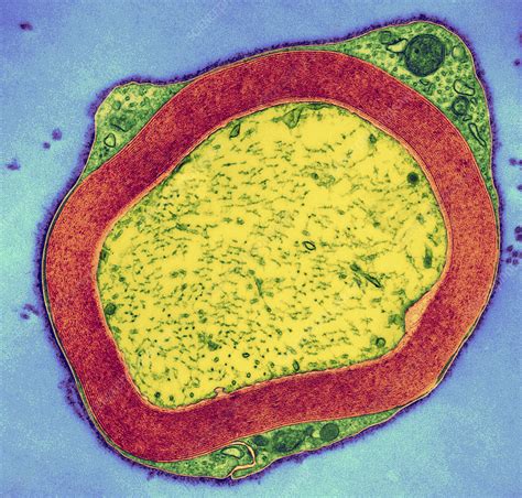 Myelinated Nerve TEM Stock Image P350 0093 Science Photo Library