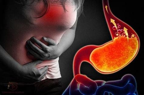 Acid Reflux And Your Sex Life Vinmec