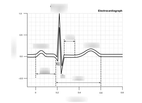 Normal Electrocardiogram Or ECG Lead II Diagram Quizlet