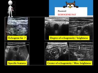 Emergency Ultrasound Course -Lecture 02 -Urgent sonographic signs -Part 2 | PPT