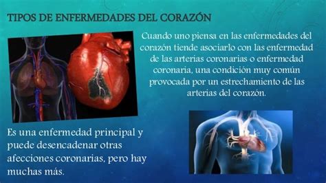 Enfermedades Del Corazon