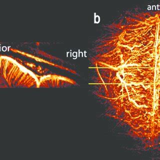 Maximum Intensity Projections MIPs Of The 3D Vascular Network In The