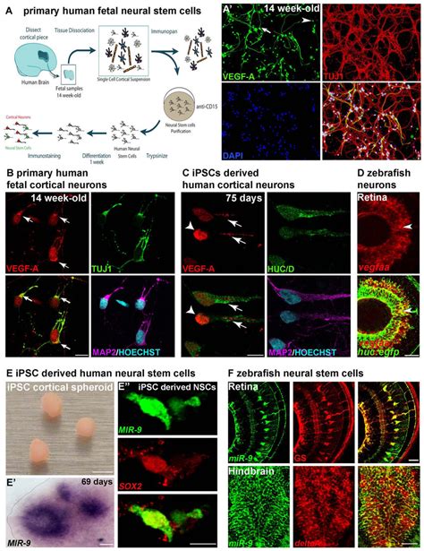 Neuronal Vegf A And Mir Expression In Nscs Are Conserved In The Human