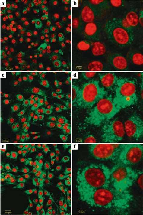 Confocal Fluorescence Images Of C Glioma Cells With Coumarin Labeled