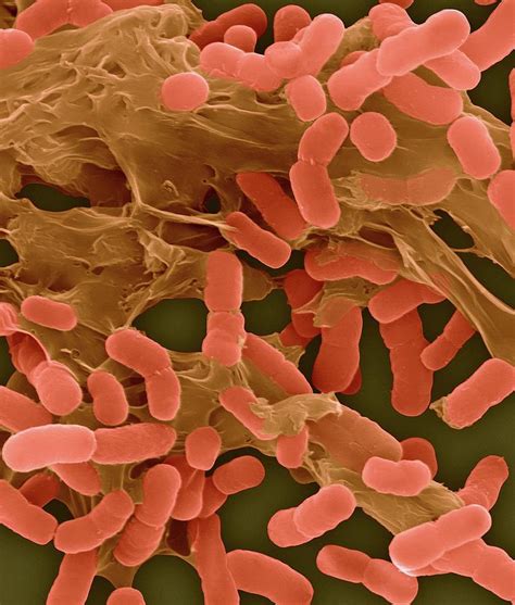 Acinetobacter Baumannii By Science Photo Library