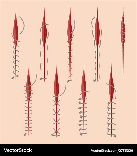 Series of different medical stitches isolated Vector Image